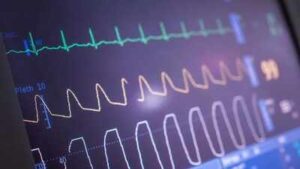 heart disease 2